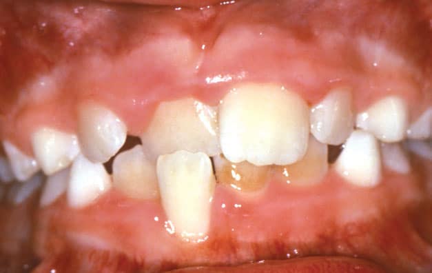 Crossbite Orthodontic Studio of Brooklyn NY
