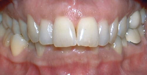 Overbite Orthodontic Studio of Brooklyn NY