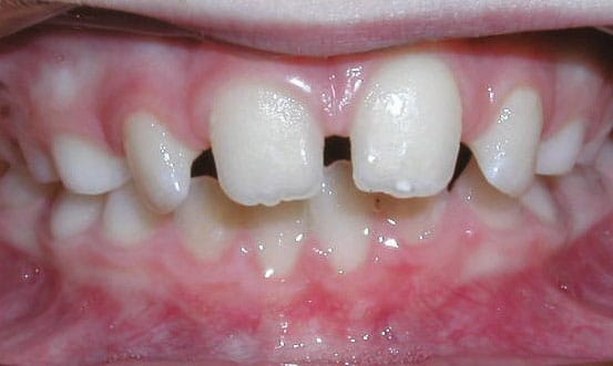 Spacing Orthodontic Studio of Brooklyn NY