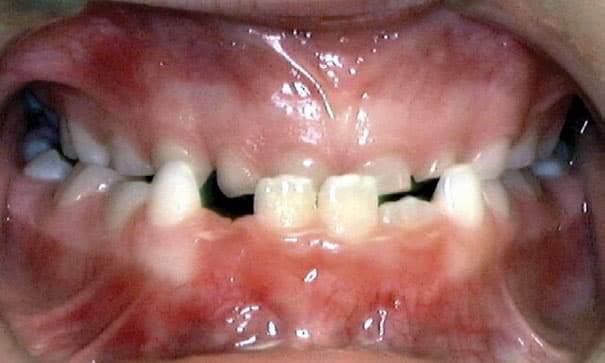 Underbite Orthodontic Studio of Brooklyn NY