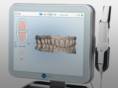 Digital Impressions Orthodontic Studio of Brooklyn NY